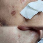 My Skin Solution | Bandar Country Homes