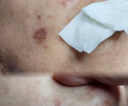 My Skin Solution | Bandar Country Homes