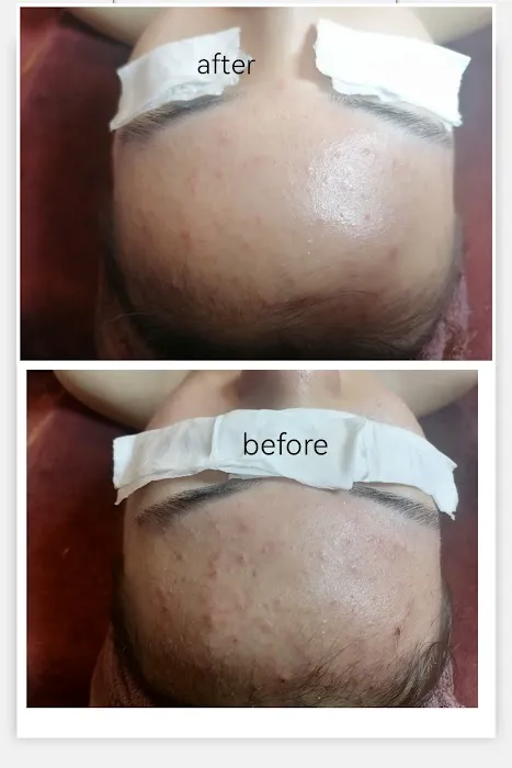 My Skin Solution | Bandar Country Homes Picture 9