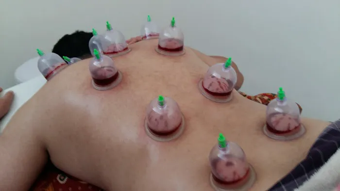 Rumah Bekam Al Azhar Picture 7