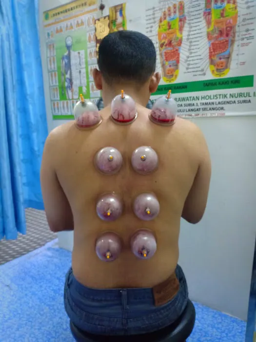 Pusat Terapi Bekam De ieman Lebu Bentong Picture 4