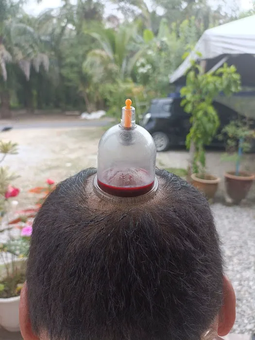 Pusat Terapi Bekam De ieman Lebu Bentong Picture 6