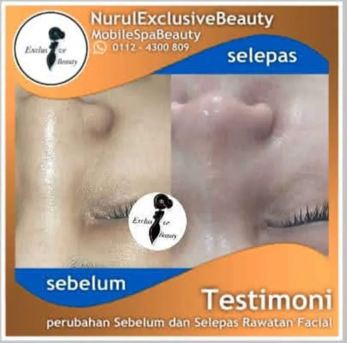 Nurul Mobile Spa Picture 10