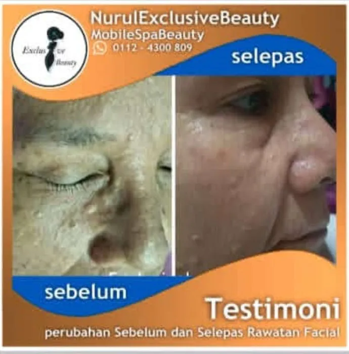 Nurul Mobile Spa Picture 8