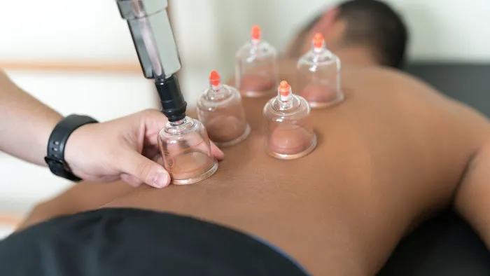Salleh Bekam Dan Urut Tradisional (B&U) Picture 1