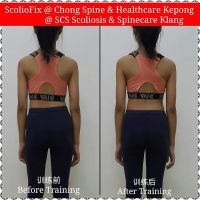 Chong Spine & Healthcare ico