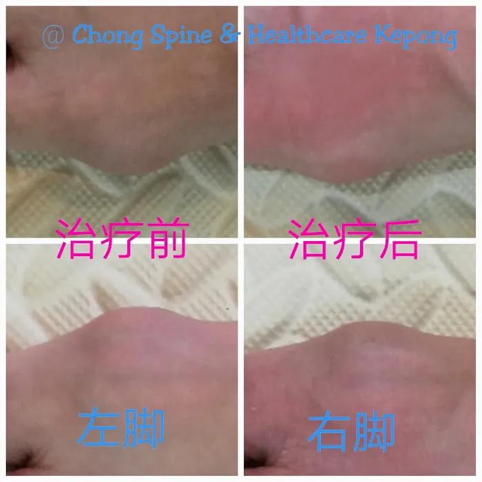 Chong Spine & Healthcare Picture 9