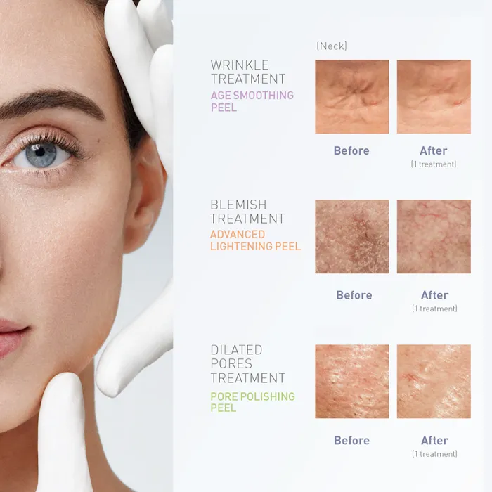 B PERFECT BEAUTY SKIN CENTRE Picture 6