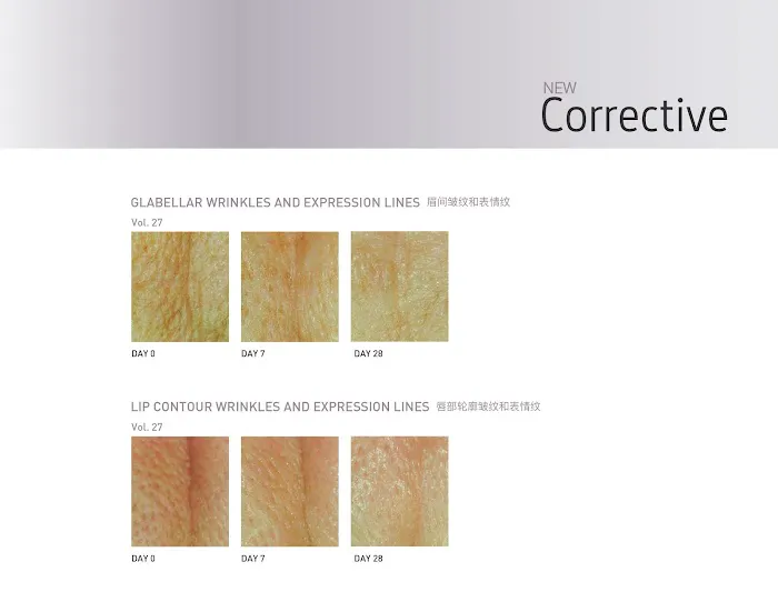 B PERFECT BEAUTY SKIN CENTRE Picture 8