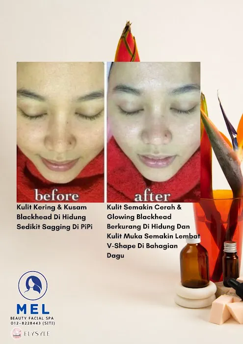 Mobile Facial Spa Picture 7