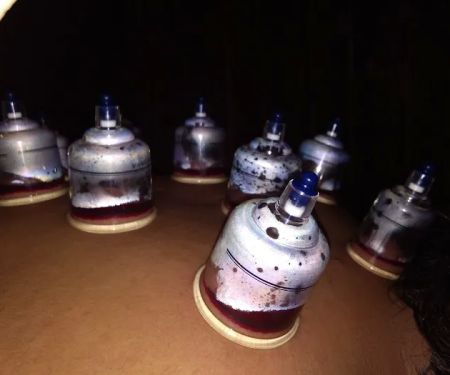 Bekam Cinta Sunnah-Kuantan