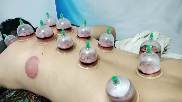 M2M SPA(SPA LELAKI) URUT BADAN/URUT BATIN/URUT KAKI/BEKAM ANGIN/BEKAM DARAH/FACIAL Picture 7