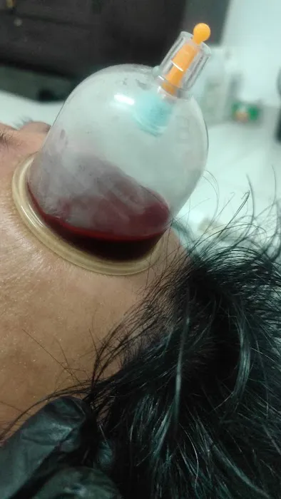 Urut tradisional | Sport Massage & Bekam | Cupping by Akmal Picture 1