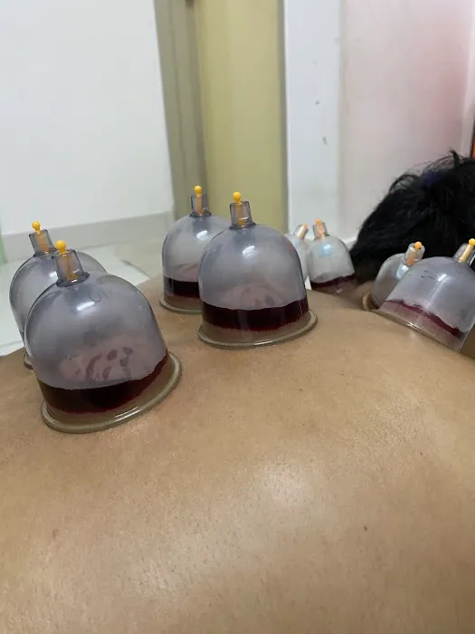 Urut tradisional | Sport Massage & Bekam | Cupping by Akmal Picture 6
