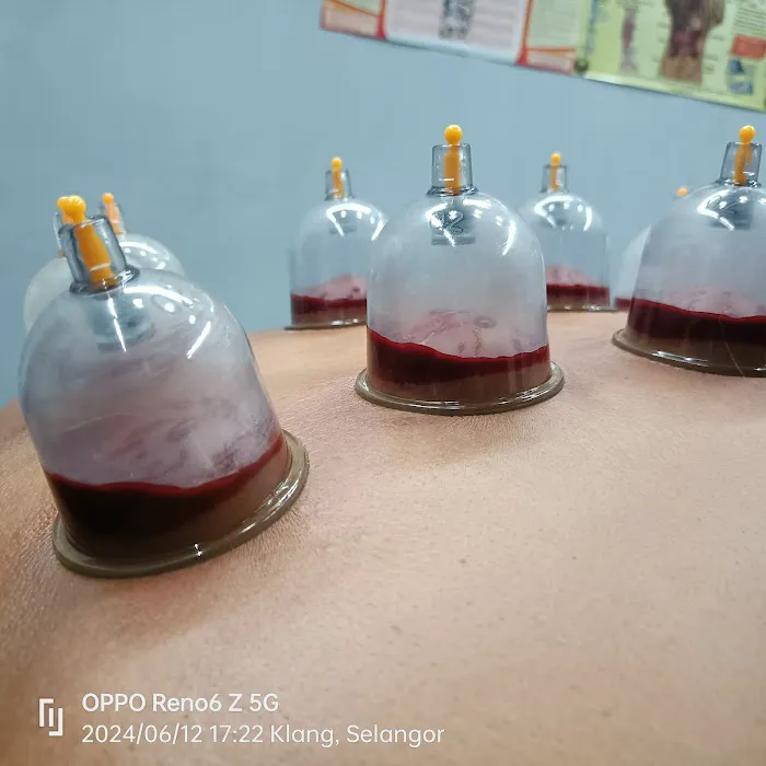 u-zack Reflexology Urut Dan Bekam Picture 6