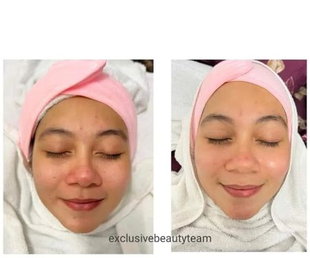 Beauty Consultant @ ALLOLABeautySpa