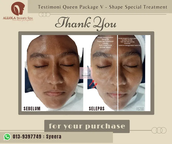 Beauty Consultant @ ALLOLABeautySpa Picture 2