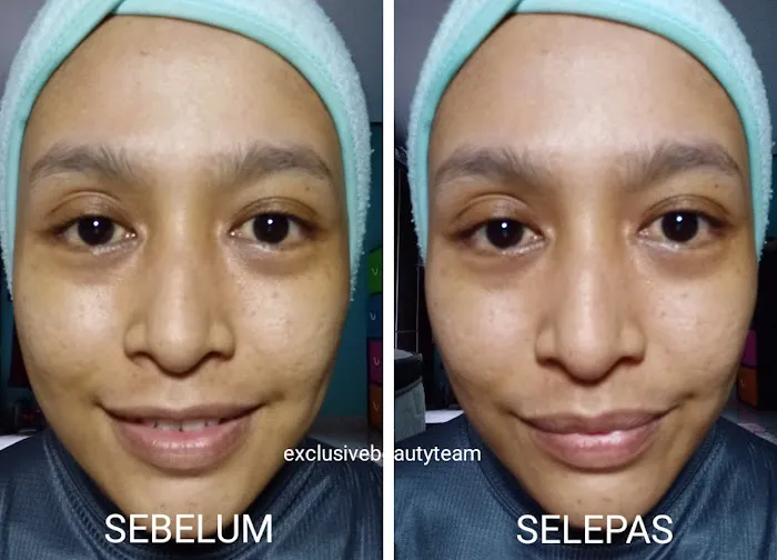 Beauty Consultant @ ALLOLABeautySpa Picture 5