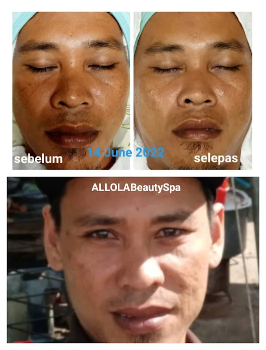 Beauty Consultant @ ALLOLABeautySpa Picture 6