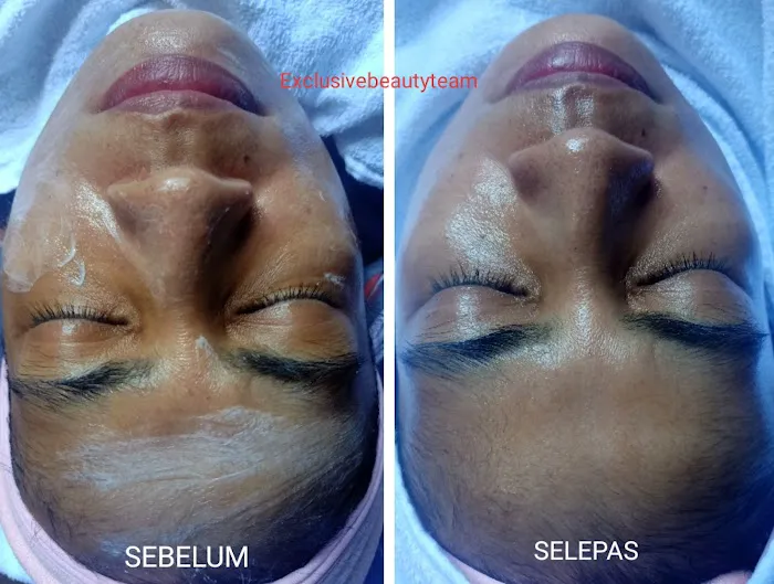 Beauty Consultant @ ALLOLABeautySpa Picture 9