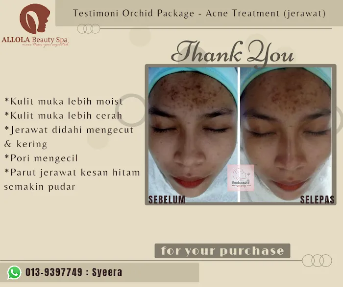 Beauty Consultant @ ALLOLABeautySpa Picture 8