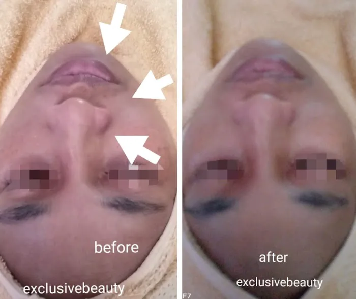 Beauty Consultant @ ALLOLABeautySpa Picture 10