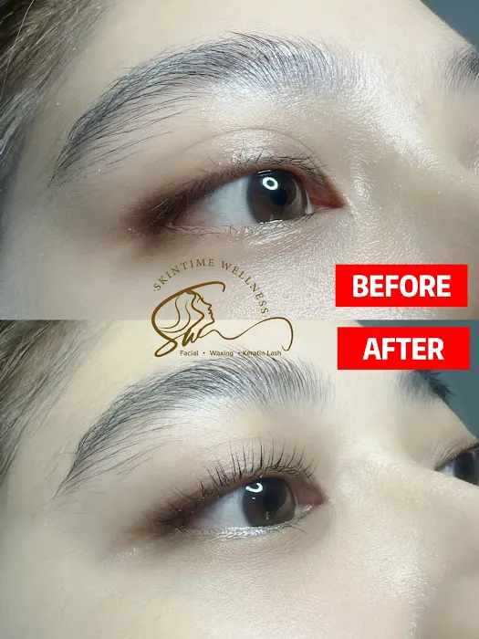Skintime Wellness Kota Bharu Picture 8