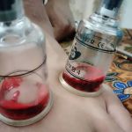URUTAN BADAN/BEKAM/KIROPRAKTIK (Urutanz_876)
