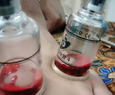 URUTAN BADAN/BEKAM/KIROPRAKTIK (Urutanz_876)