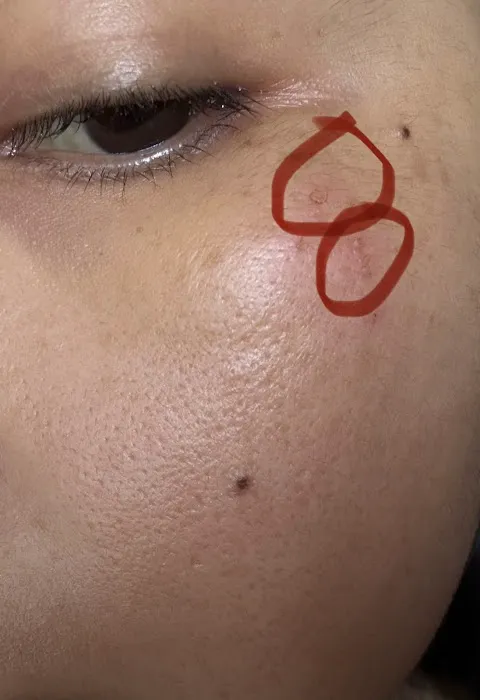 Shakura Pigmentation Beauty Klang | M'sia Most Trusted Pigmentation Solution Picture 9