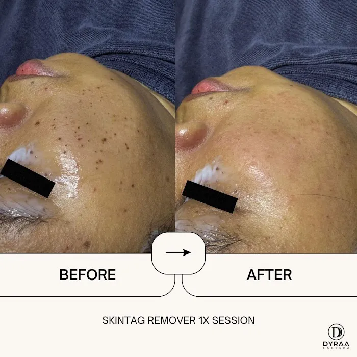 DYRAA FACESPA & HAIRSALON JERTEH Picture 5