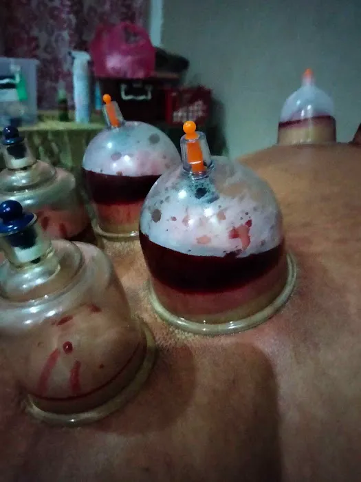 Wan Terapi URUT BEKAM Meru Klang Picture 5