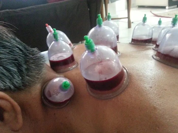 Urut dan Bekam Sunnah Suami Isteri Picture 2