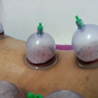 Urut dan Bekam Sunnah Suami Isteri ico
