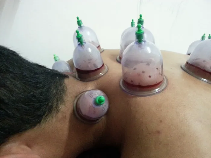 Urut dan Bekam Sunnah Suami Isteri Picture 5