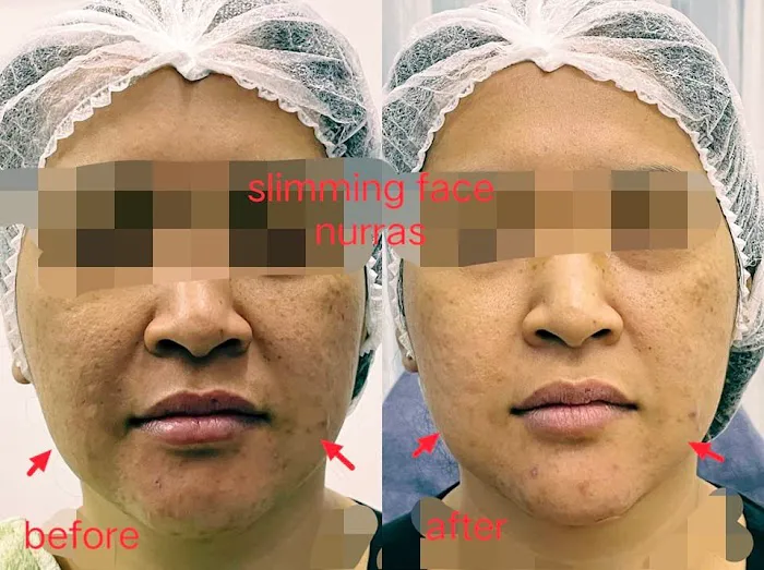 NURRAS BEAUTY SKINCARE & SPA Picture 4