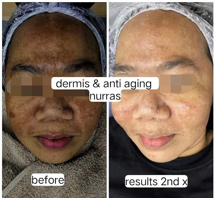 NURRAS BEAUTY SKINCARE & SPA Picture 8