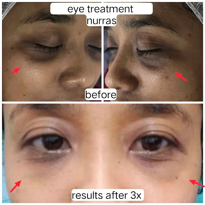 NURRAS BEAUTY SKINCARE & SPA Picture 6