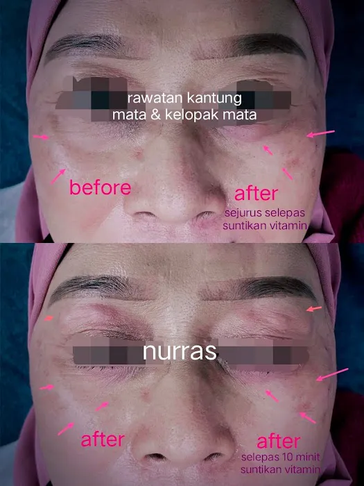 NURRAS BEAUTY SKINCARE & SPA Picture 9