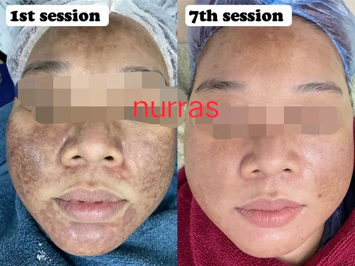 NURRAS BEAUTY SKINCARE & SPA Picture 10
