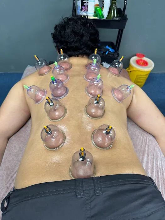 Tukang Urutan Badan dan Bekam Abe Rie Picture 1