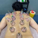 Tukang Urutan Badan dan Bekam Abe Rie