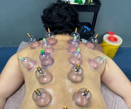Tukang Urutan Badan dan Bekam Abe Rie