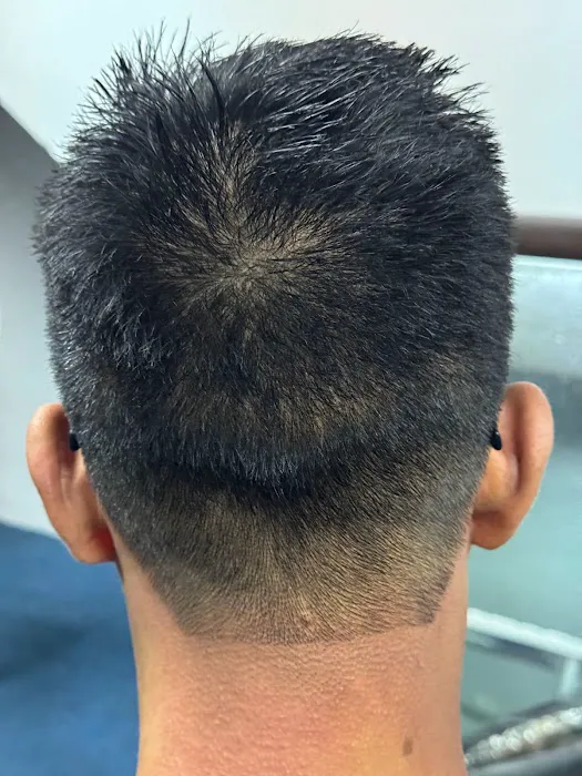 Tukang Urutan Badan dan Bekam Abe Rie Picture 8