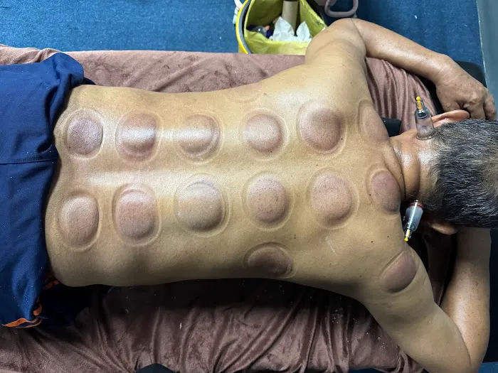 Tukang Urutan Badan dan Bekam Abe Rie Picture 6