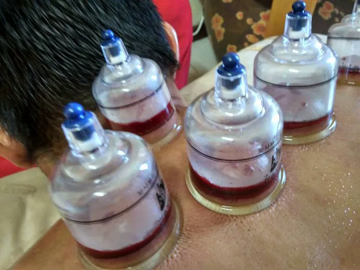 Urut Bekam DC Picture 2