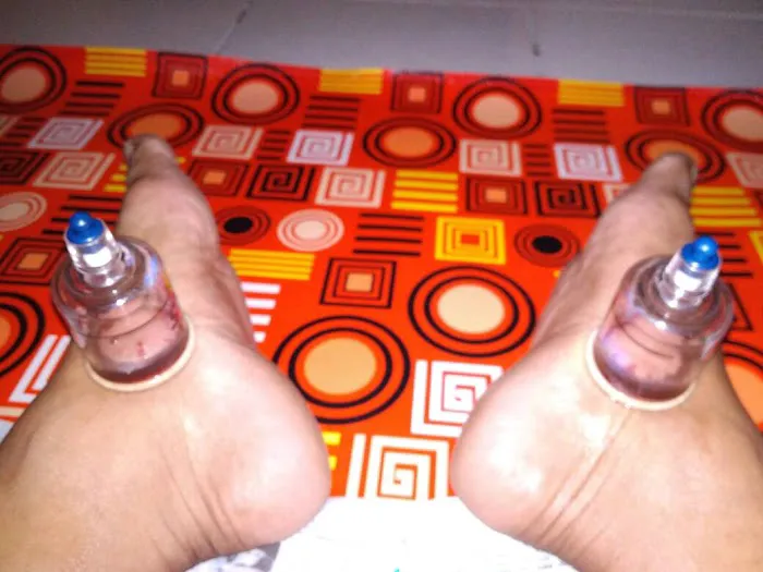 Urut Bekam DC Picture 5