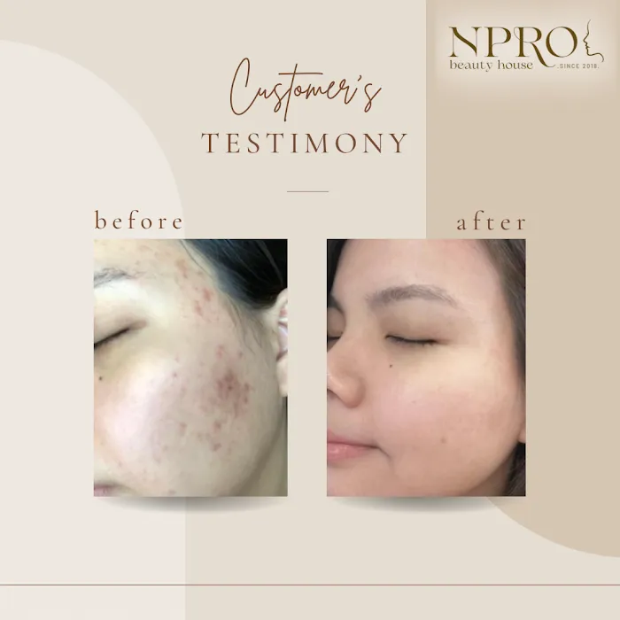 Npro Beauty House Picture 10