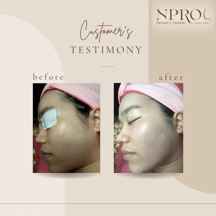 Npro Beauty House Picture 9