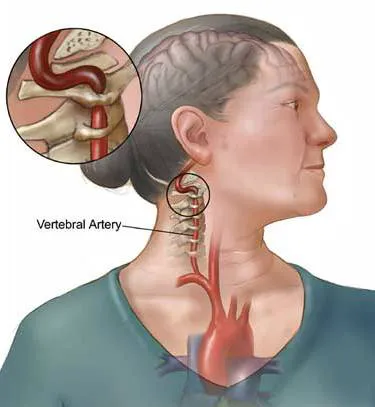 urutan tradisional dan bone adjustment senawang Picture 5